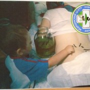 Внук Али маленький гирудотерапевт