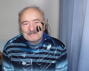 Пациент с пиявками